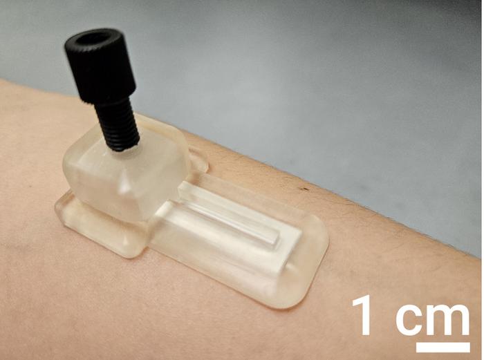 Microneedle patch monitors biomarkers