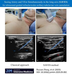 Seeing Artery and VEin Simultaneously in the long axis (SAVES)
