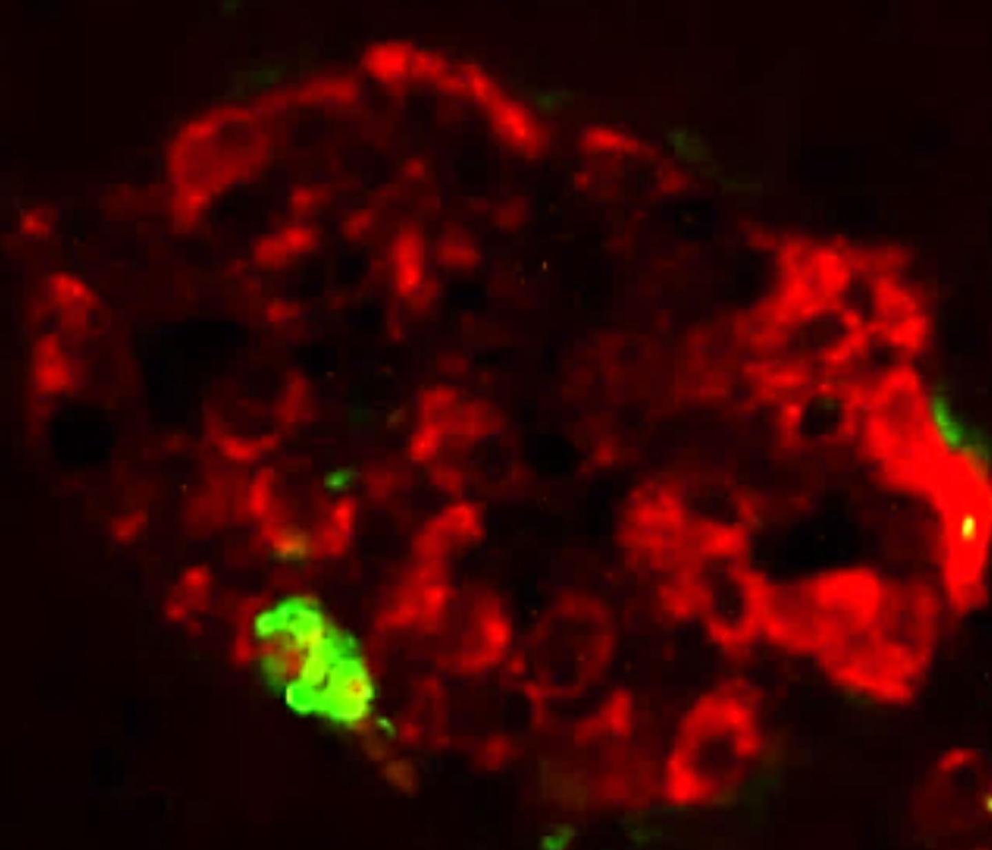 Misfolded IAPP Induces Protein Aggregation