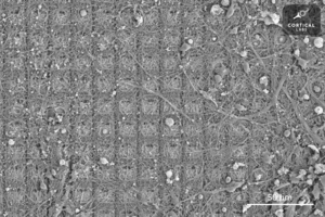 Neural culture