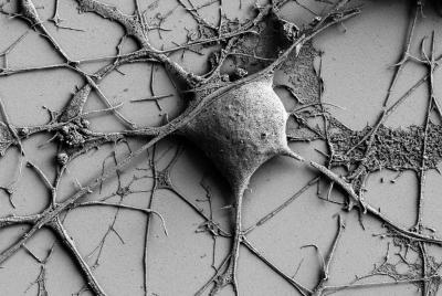 Neuron