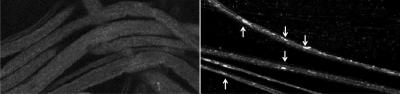 Traffic Jams in the Brain