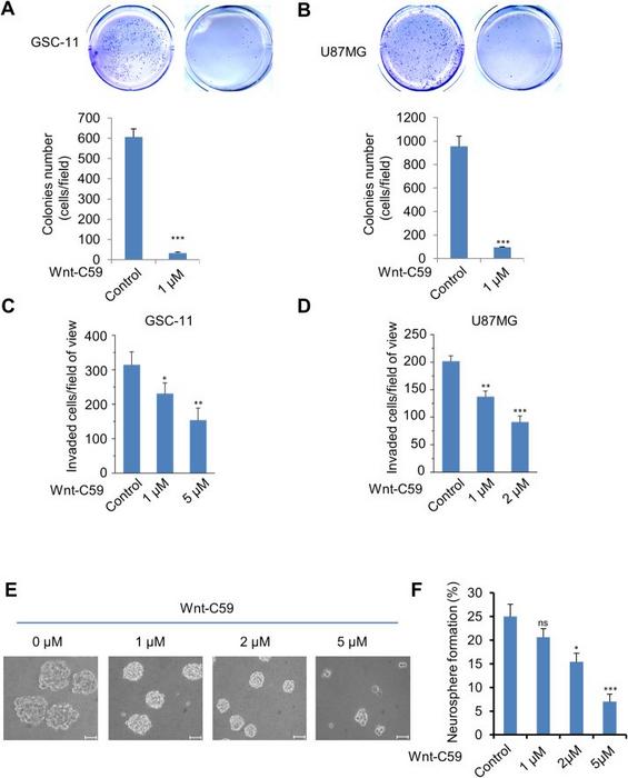 Wnt-C59 inhibits tumorgenicity of glioblastoma.