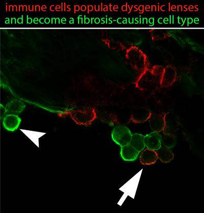 The Eye is Not Immune to Immunity