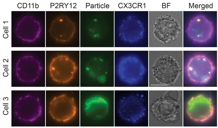 iPSC-derived microglia cells in a dish