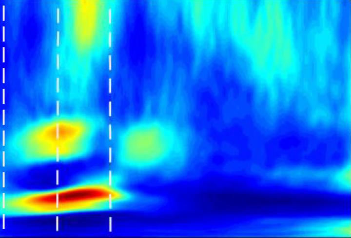 Mouse Brain Recordings