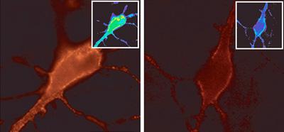 PIKfyve Directs Calcium Channel Degradation