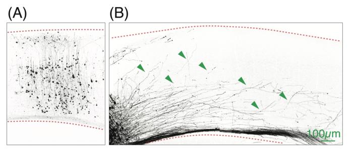 Visual cortex nerve-fiber growth