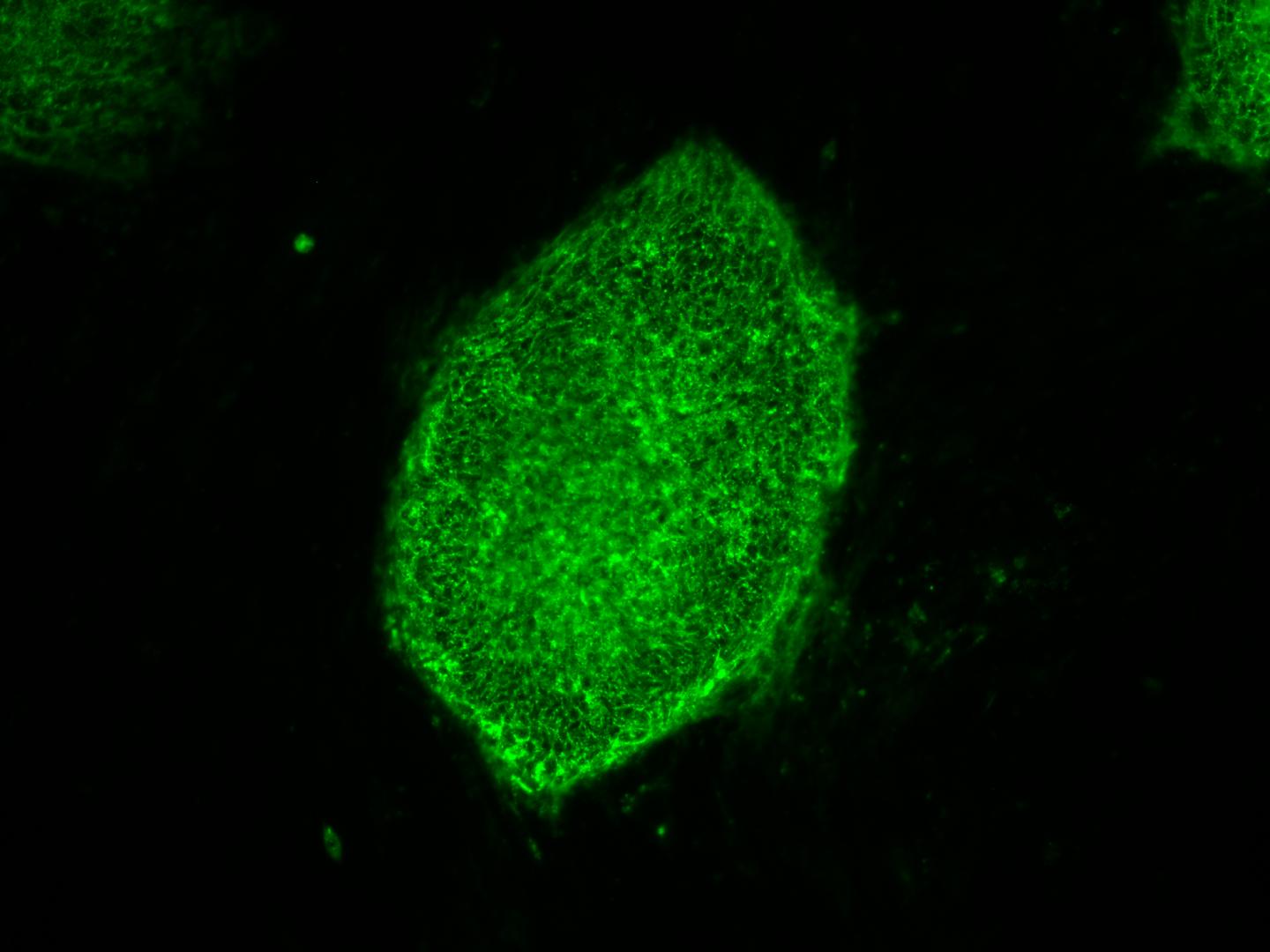 Induced Pluripotent Stem Cell