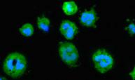 Neutrophil (2 of 2)