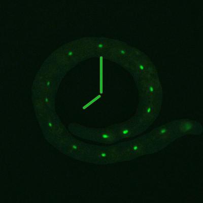 Gonad Signals Link Development and Longevity (1 of 1)