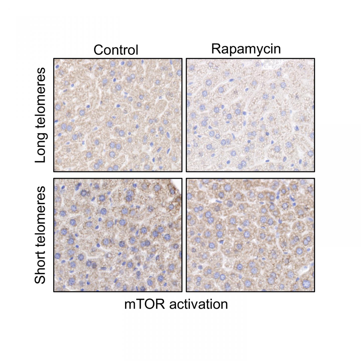 Inhibition of mTOR Activity in Liver Samples