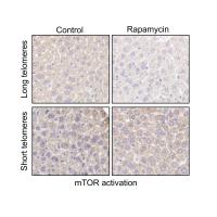 Inhibition of mTOR Activity in Liver Samples