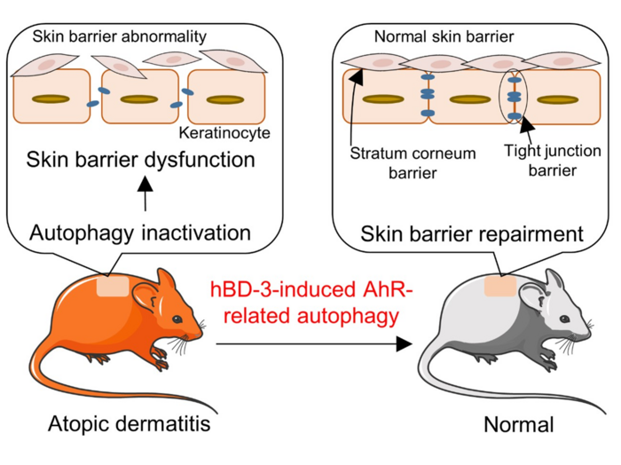 Dysfunctional autophagy plays a crucial role in generating epidermal barrier defects