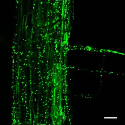 Plant Root Bacteria