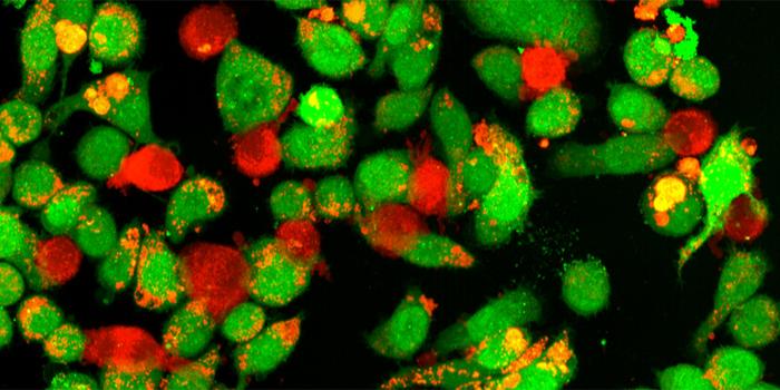 Macrophages and tumor cells