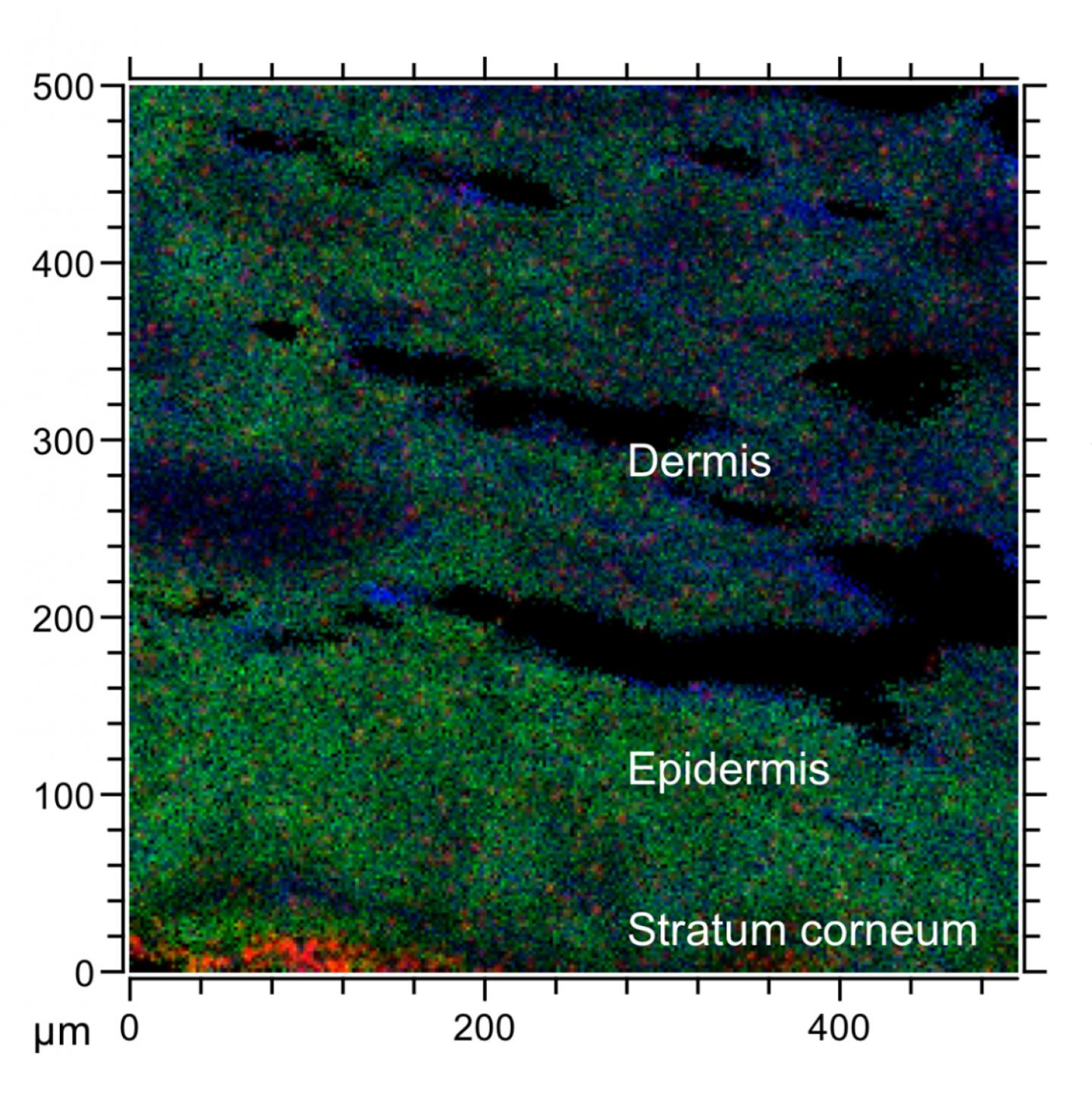 3-D Imaging of a Skin Section