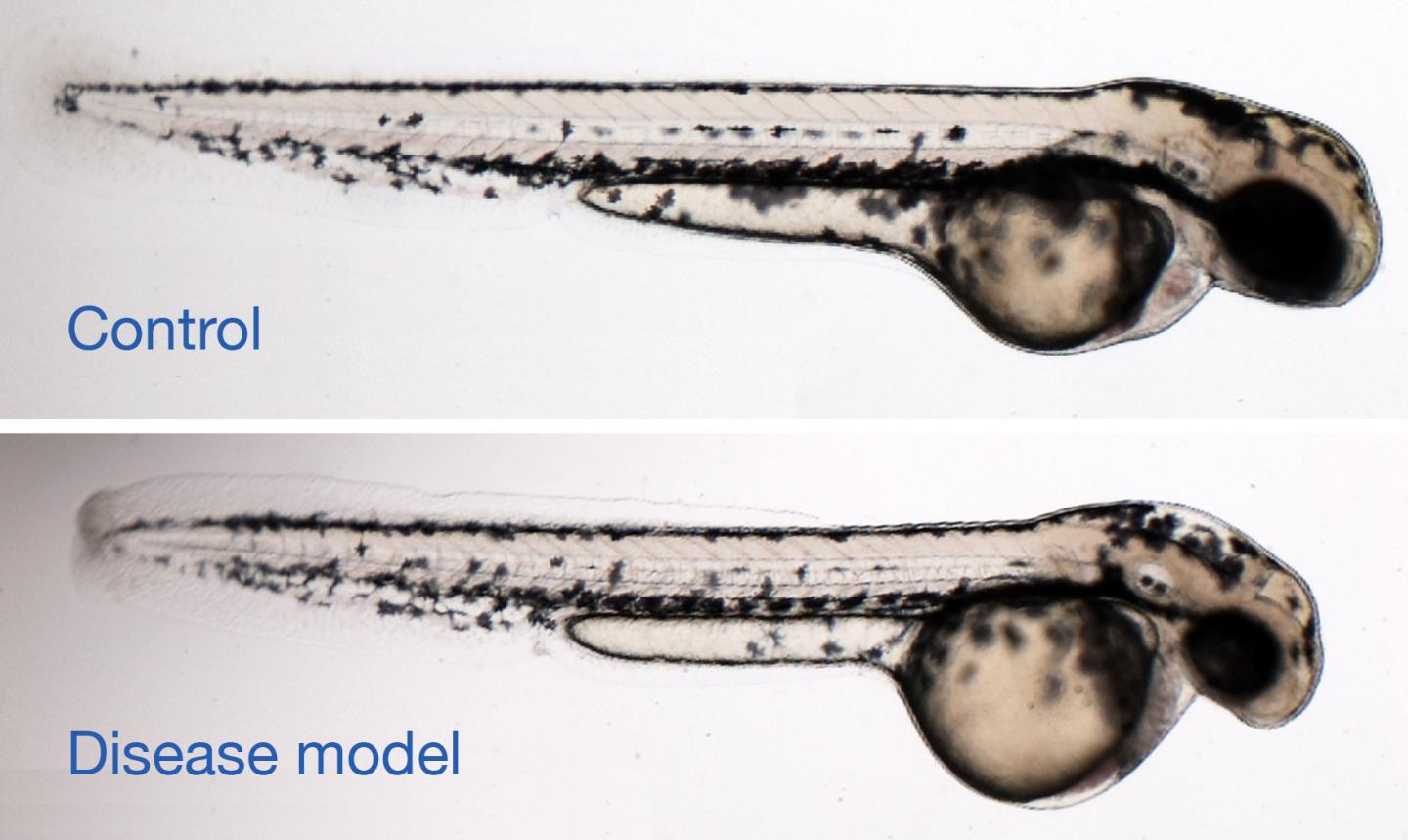 Zebrafish Microcephaly