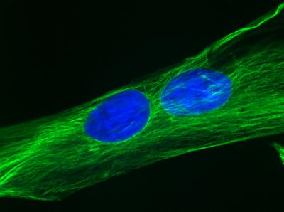 2 Fat-Derived Stem Cells