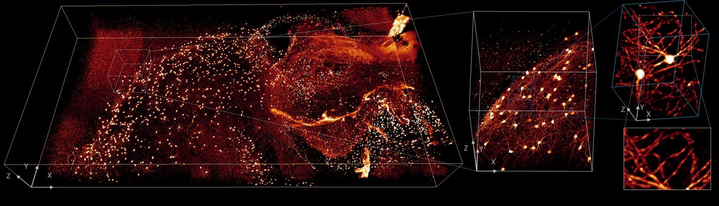 Fluorescence Imaging of a Mouse Brain