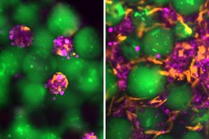 Engineered liver grafts