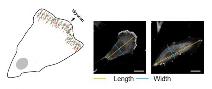 Moving Fibroblasts