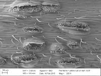 Electron Microscopy Image of Wheat Yellow Rust Infection