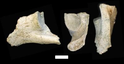 Lower Hip Bone