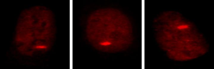 Cancer Cell