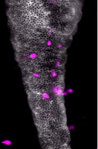 How The Microbiota Controls Neutrophil Activity