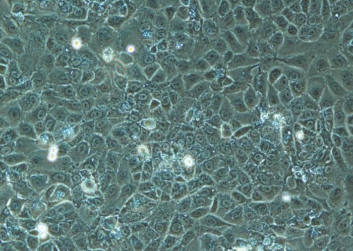 A platform to test new cancer treatments