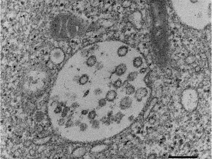 Transmission electron micrograph (TEM) of hantavirus particles in an infected kidney cell of a grey red-backed vole.