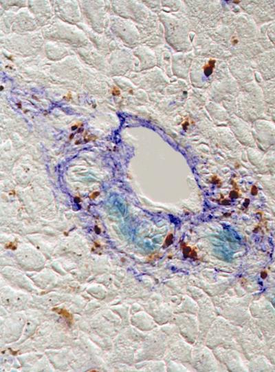 Liver Stem Cells