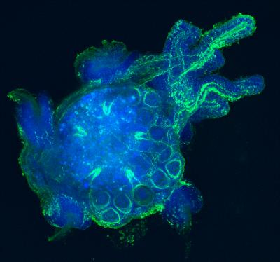 Histamine Staining of Purple Sea Urchin