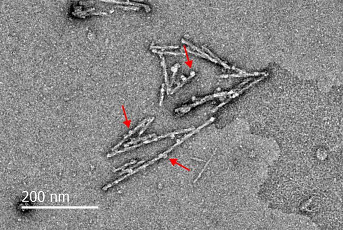 Electron Microscopy Image of Funes - Orb2 amyloid