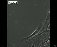 Synoviocyte Migration
