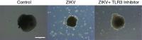 Zika-Infected Brain Organoid with TLR Inhibitor