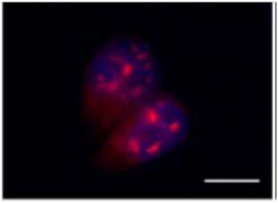 RNA Ultraconservated