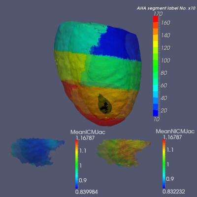 Geodesic Positioning of 25 Subjects