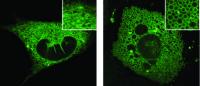 Endoplasmatic Reticulum