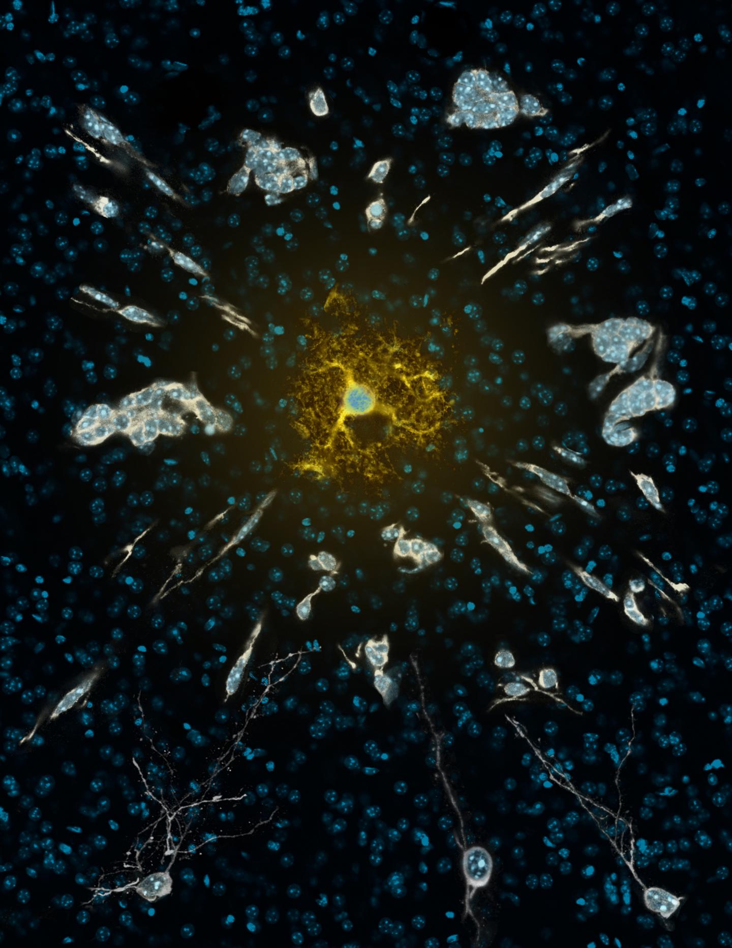 The Hidden Talents of Astrocytes in Mice (2 of 3)