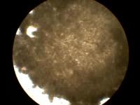 Spontaneous Beating of Heart Repair Patch