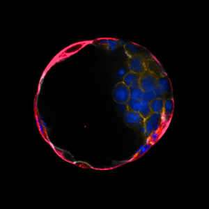 A mouse blastoid fluorescently stained for various cellular components_2