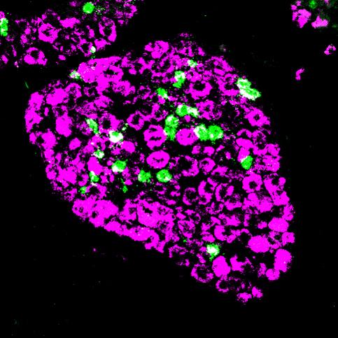 Scratching an Itch in Mice with New Small Molecule Inhibitors (2 of 6)
