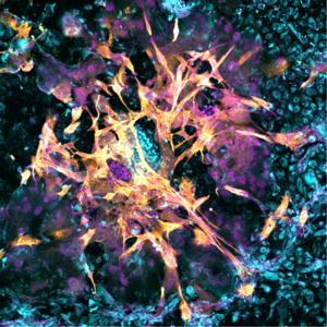 Microscopy image of a day 14 human embryo that has implanted in the new endometrial model