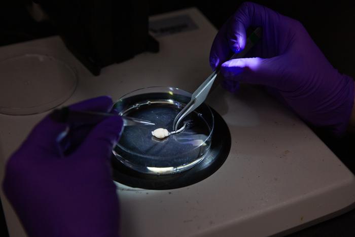 Opioid Clinical Trial