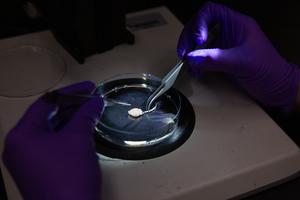 Opioid Clinical Trial
