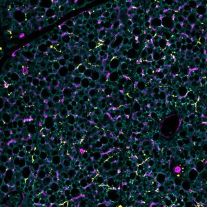 Brown fat cells with blood vessels and nerves