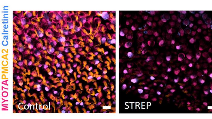 Researchers identify genetic mechanisms involved in a disorder that affects balance cells in the ear