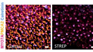 Researchers identify genetic mechanisms involved in a disorder that affects balance cells in the ear